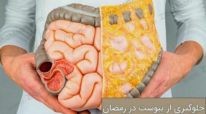 یبوست در رمضان