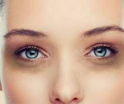 توصیه های حلقه های سیاه دور چشم